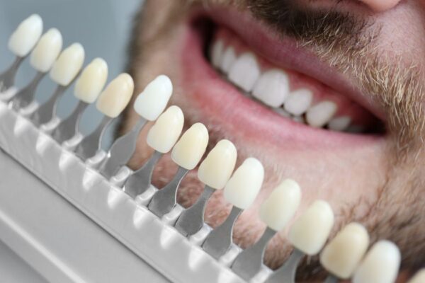 RNX Dental SEO Images (5)-min